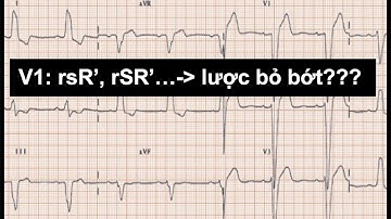 Đọc Điện tâm đồ(ECG): video 21: Tổng quan về Block nhánh