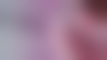 FTRD® System | Hybrid FTRD | Resection of recurrent sigmoidal adenoma