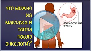 Что Можно из Массажа и Тепла После Онкологи? Что Можно из Массажа и Тепла После Онкологи?