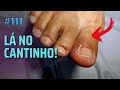 LÁ NO CANTINHO ( "NAIL LOVERS" )#PODOLOGOMAURELIO #PODOLOGIA#UNHAENCRAVADA