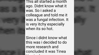 How i used Brake and Clutch fluid to treat Tinea Versicolor