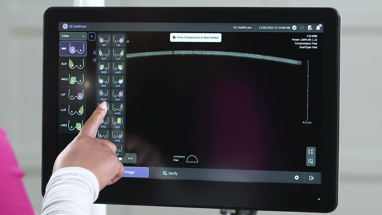 Invenia™ ABUS Premium Acquisition Video (EU Version) | GE HealthCare