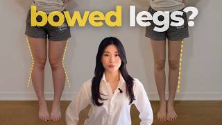 How To Fix Bowed Legs For Long And Lean Legs