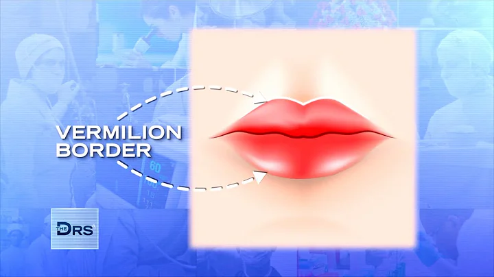 Do Lip Fillers Make Your Lips Worse Over Time?