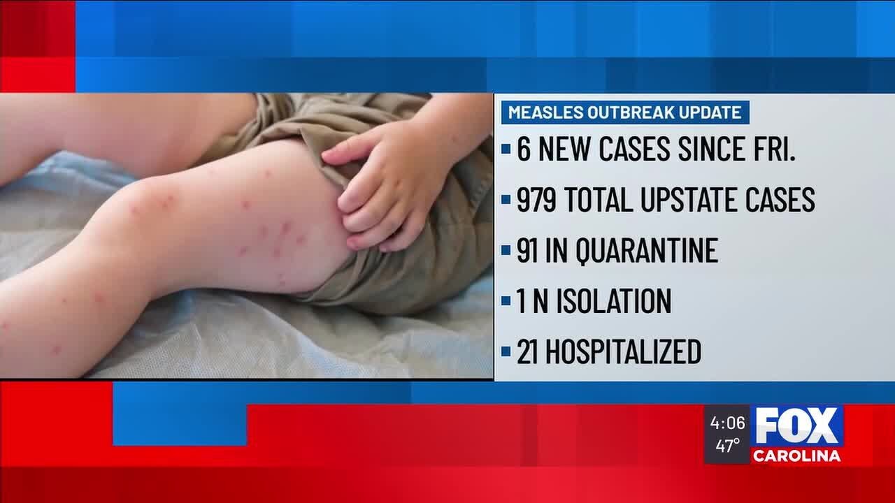 DPH: Additional school identified, 21 hospitalized in Upstate measles outbreak
