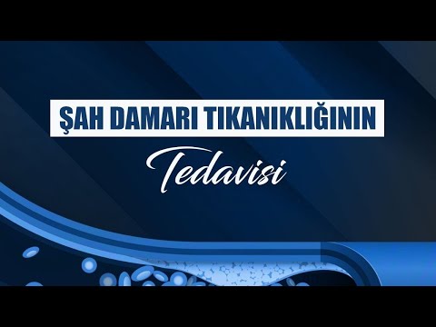 Şah Damar Tıkanıklığı Tedavisi - Prof. Dr. Şevket Görgülü