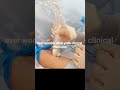 procedure #usnurse #nursing #lifeisbutadream #follow #nurselife #nurse #nurseopedia_india