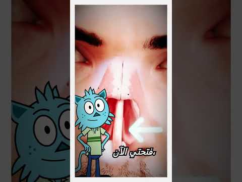 نخز الأنف قد ي سبب ثقب ا