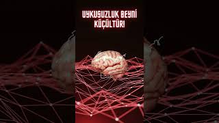Uykusuzluk Beyni Küçültür