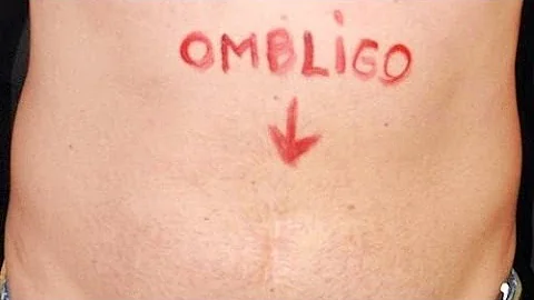 ¿Se puede nacer sin ombligo?