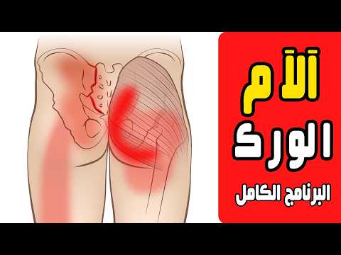عالج ألم الورك المفصل العجزي الحرقفي ألم أسفل الظهر والمقعدة خطة علاجية محكمة ومتكاملة
