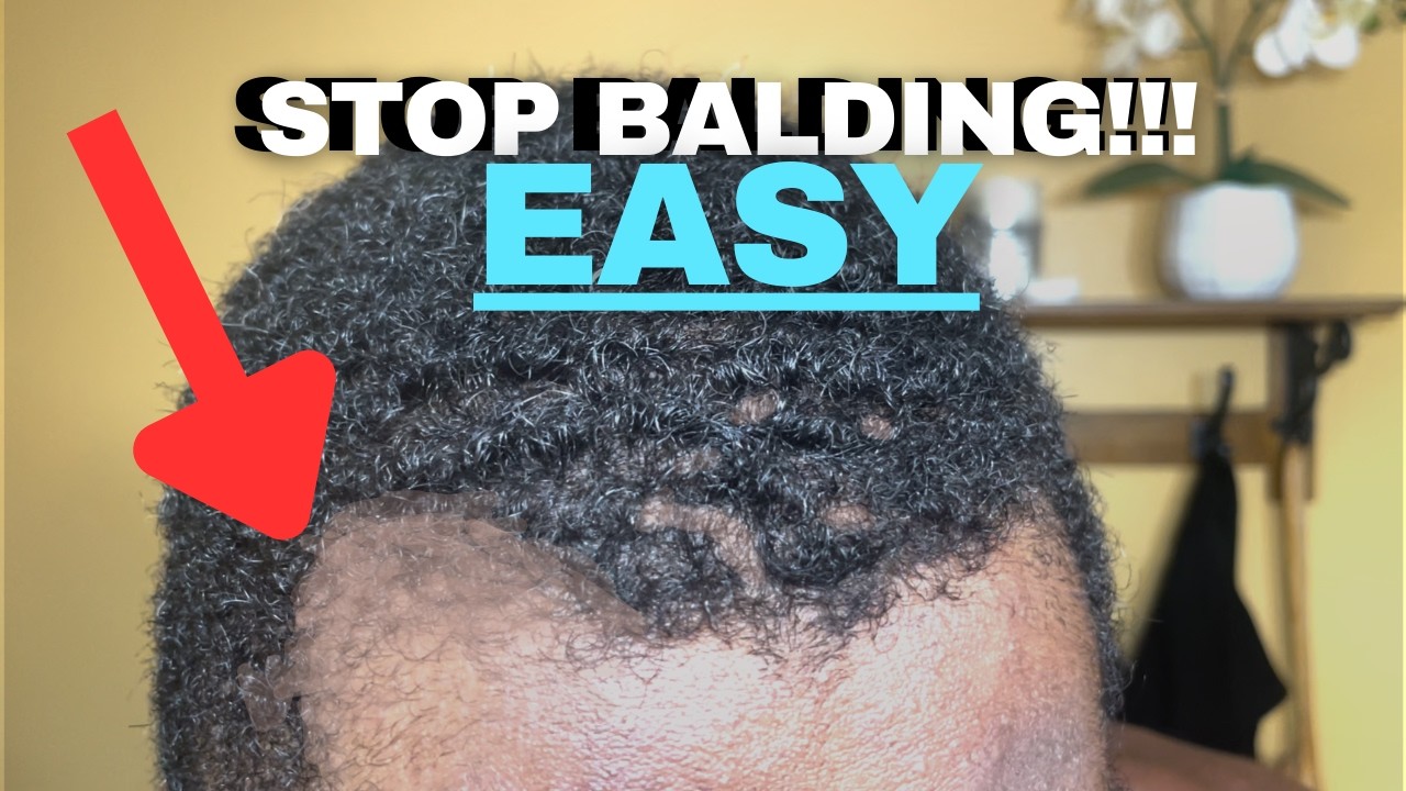 3 Ways To Put Hair BACK on Your Head | Hair Loss Prevention & Hair Growth (NO MINOXIDIL)