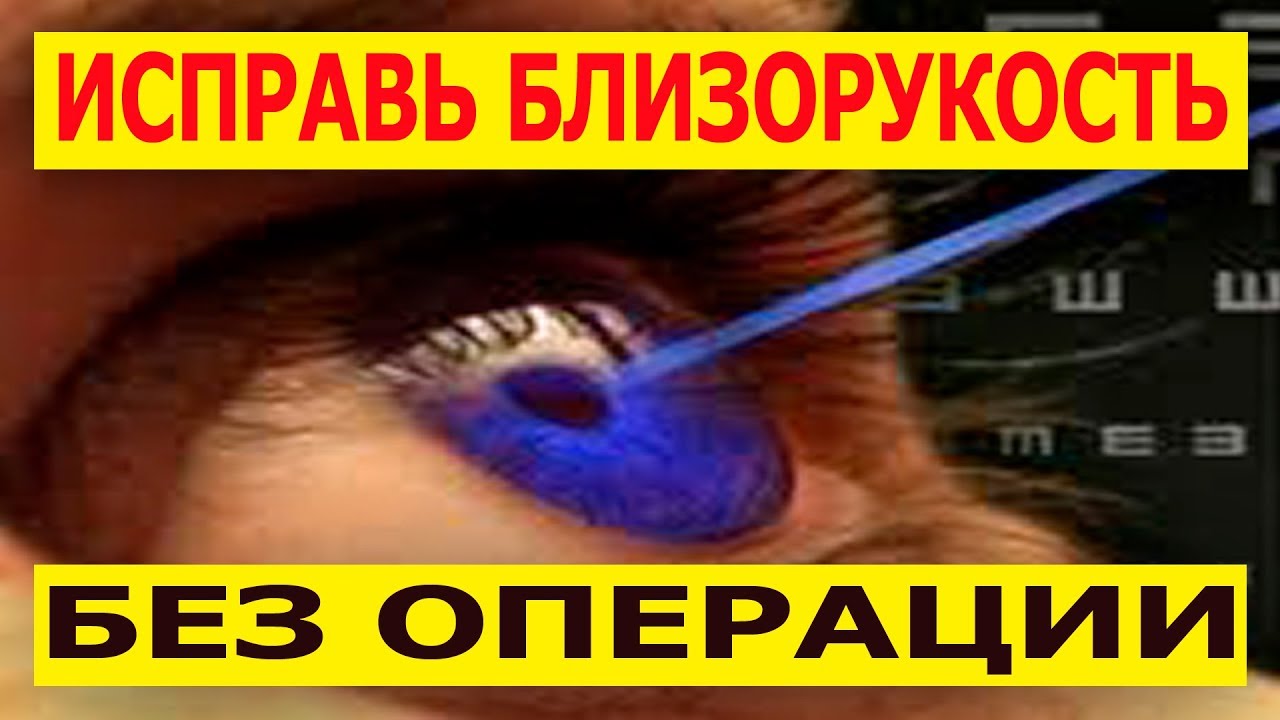 Как улучшить зрение близорукость, в домашних условиях, за короткий срок ...