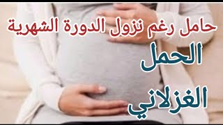 اعراض الحمل الغزلاني بالتفصيل