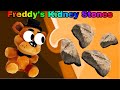 FNaF Plush: Freddy’s Kidney Stone