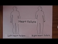 Heart Failure 7, Clinical features