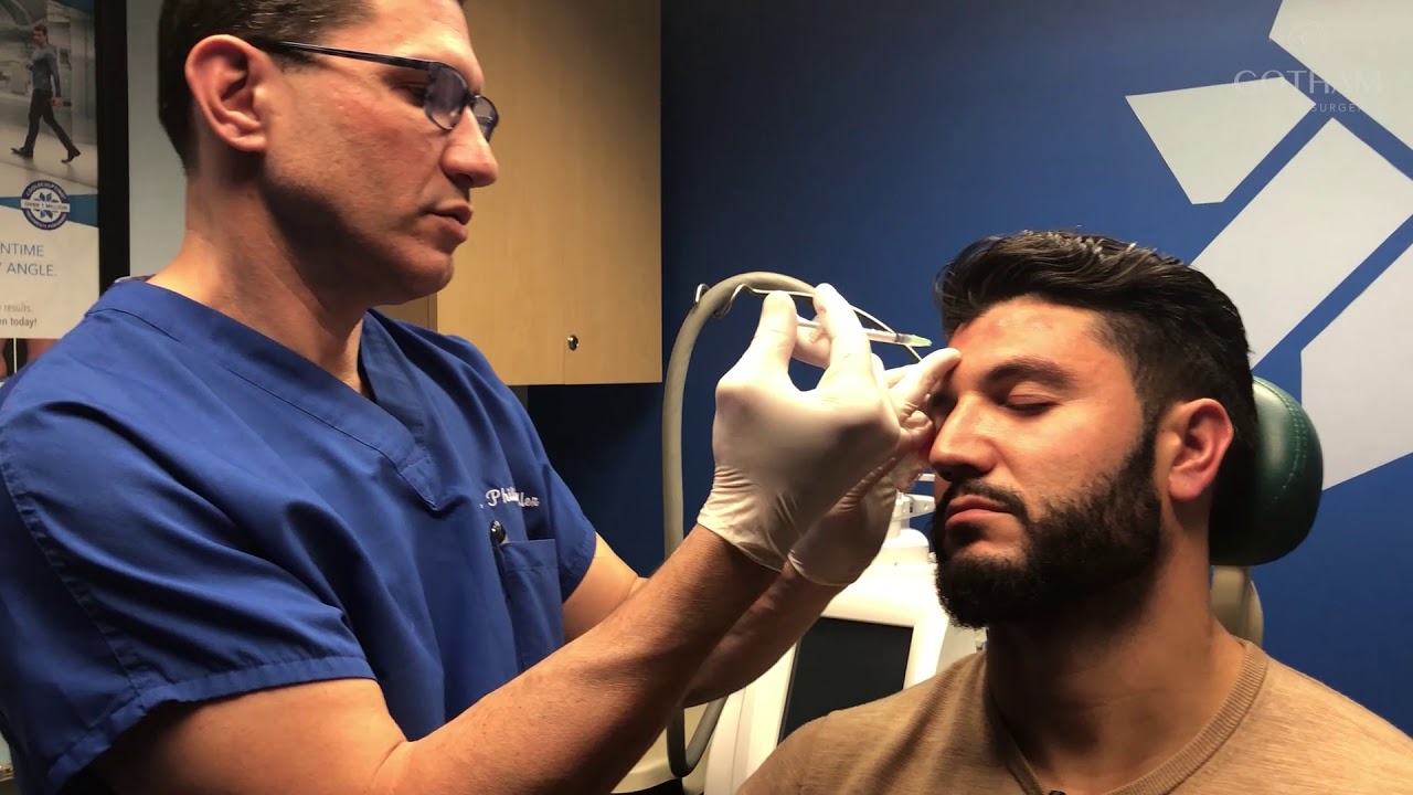Brotox Facial Wrinkle Treatment with Dr. Miller