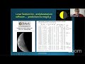 Observing Occultations - BAA Weekly Webinar