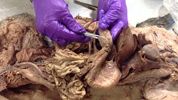 A&P 2 - Lab Practical 2 - Female Reproductive and Digestive 2