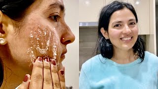 How To Get Rid of Dark Scars, Hyperpigmentation, Pimples/Acne And Get Glowy Fair Skin Naturally