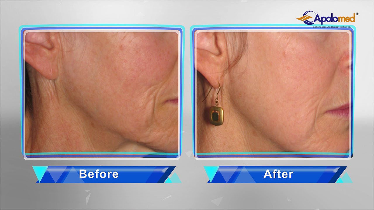 HS 510 видео инсталяция