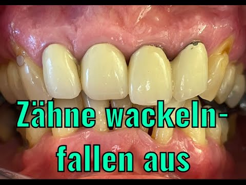 Video: Deutscher Schäferhund Zähne und Zahnfleisch Gesundheit