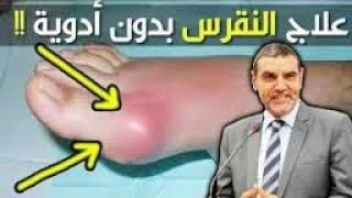 الدكتور محمد الفايد يخرج عن صمته ويعلن دواء للنقرس( اليوريك أسيد) امام ذهول الاطباء