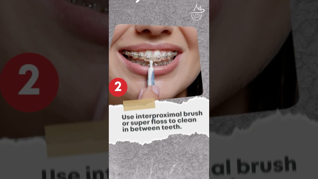 How to Take Care of Your 