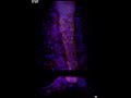 In Toto Imaging Of Zebrafish Neural Tube