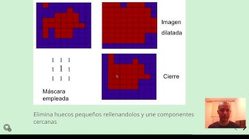 Operaciones morfologicas