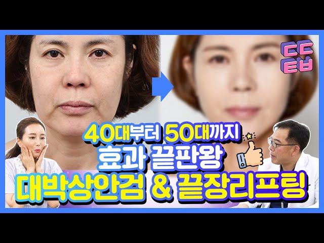 [안티에이징] 상안검하안검 리프팅으로 한방에 눈처짐, 팔자주름 고민해결~!