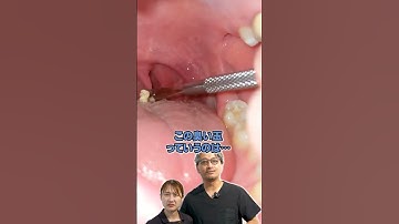 臭い玉#shorts