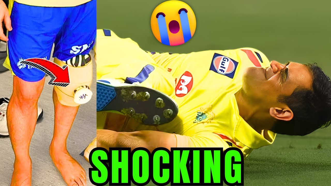Breaking: MS Dhoni Injury Update - What Happened? 😭😮