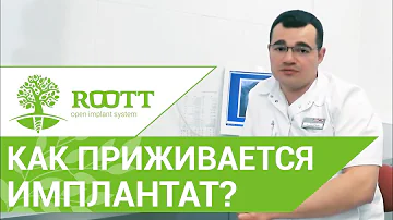 ☝ Как и сколько времени длится приживление импланта. Признаки отторжения имплантата