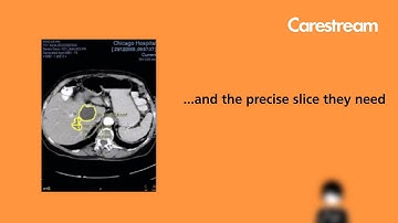 CARESTREAM Vue Reporting - The wind of change is blowing through the world of reporting