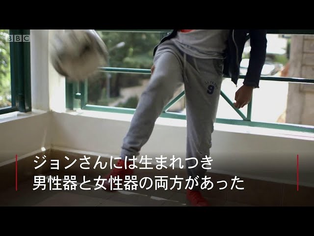 性未分化で生まれた赤ちゃん 手術で性を決めて良いのか Youtube