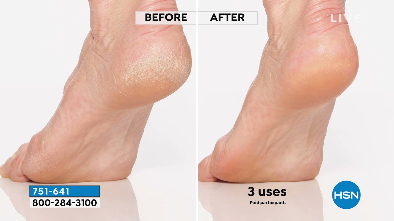 Finishing Touch Flawless Pedi YouTube