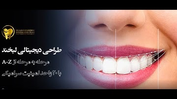 طراحی لبخند دیجیتال دکتر گشاده‌رو _ Step by step to a customize smile design