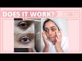 I tried eye patches for 14 days ✨ *Before & After results* with Jayjun green tea 🌱 eye patches