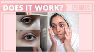 NO MORE DARK CIRCLES? I TRIED EYE PATCHES FOR 14 DAYS ✨ Before & After screenshot 3