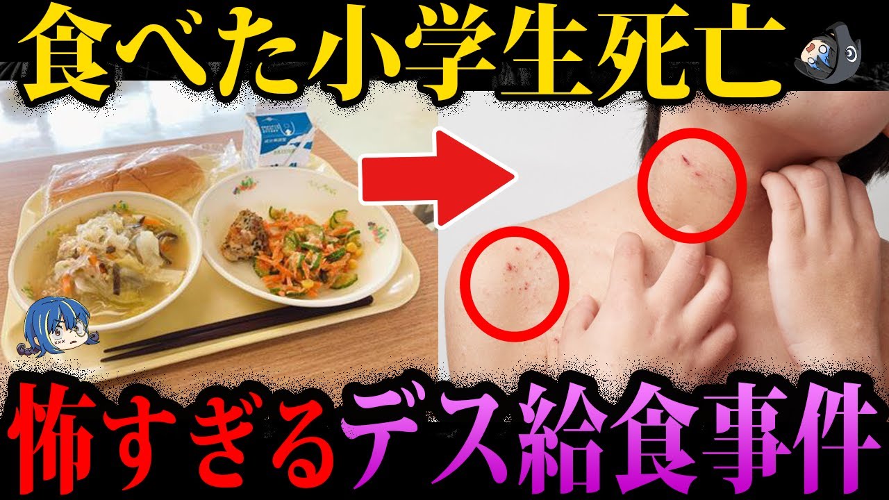 【ゆっくり解説】小学生が●亡…。本当にあったデス食品事件５選