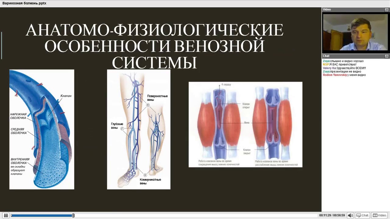 Варикозная болезнь профилактика и комплексное лечение, вебинар д ра В ...