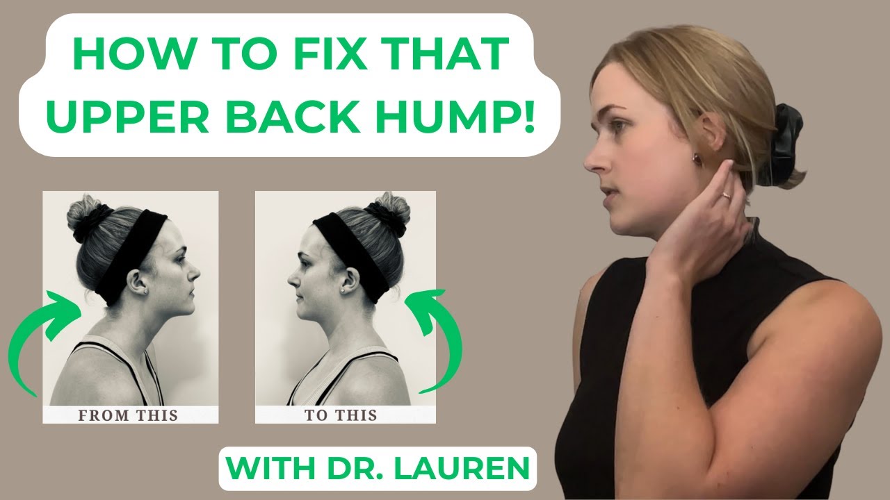 HOW TO FIX THAT UPPER BACK HUMP! YouTube