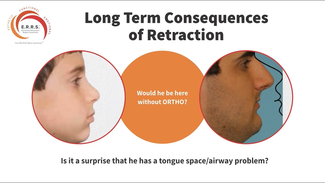 Long Term Consequences of Retraction YouTube