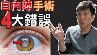 白內障手術後看不清楚? 這四個錯誤你一定要避免！