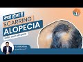 Scarring Alopecia क्या होता है? | Hair Expert से जानिए इसके कारण और इलाज | Dr. Alok Sahoo