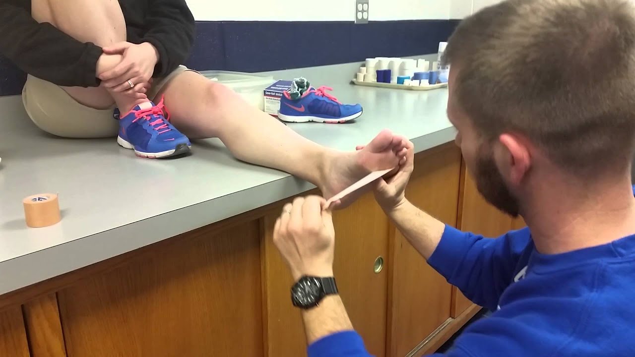 Plantarflexed First Ray