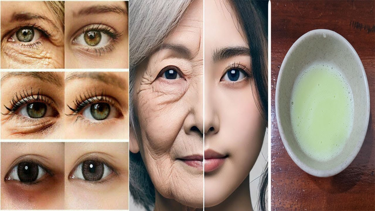 Magical Cream Reduces Wrinkles and Eye Bag.