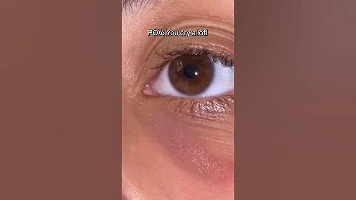 Crying a lot can also cause puffy eyes and dark circles! #crying