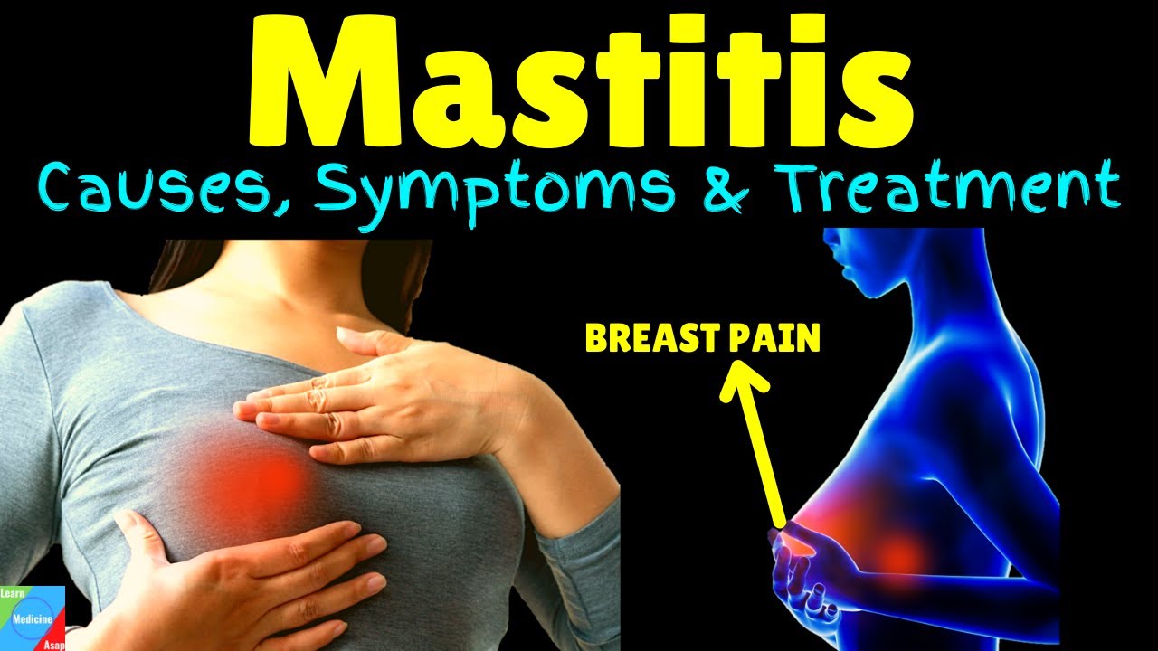 Mastitis - Symptoms, Treatment & Causes